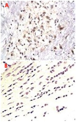 NPY Rabbit anti-Human, Mouse, Rabbit, Rat, Polyclonal Antibody, Abnova