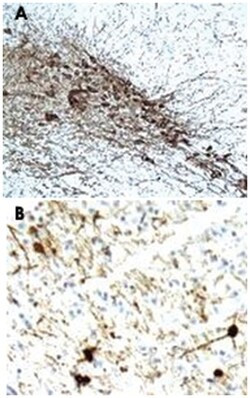 TH Rabbit anti-Human, Mouse, Rat, Polyclonal Antibody, Abnova 100 &mu;g | Buy Online | Abnova Corporation | Fisher Scientific