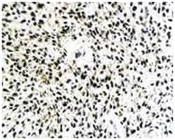 SOCS1 Rabbit anti-Human, Mouse, Rat, Polyclonal Antibody, Abnova 100 &mu;g | Buy Online | Abnova Corporation | Fisher Scientific
