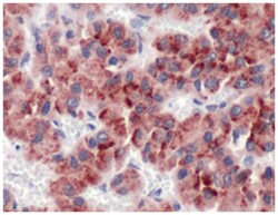 GPC3 Rabbit anti-Human, Polyclonal Antibody, Abnova 100 &mu;L | Buy Online | Abnova Corporation | Fisher Scientific