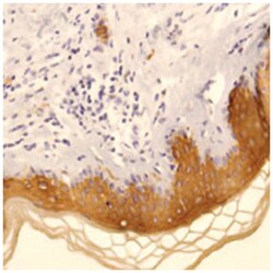 KRT10 Rabbit anti-Human, Polyclonal Antibody, Abnova 100 &mu;L | Buy Online | Abnova Corporation | Fisher Scientific