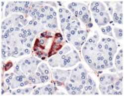 VCL Rabbit anti-Human, Polyclonal Antibody, Abnova 100 &mu;L | Buy Online | Abnova Corporation | Fisher Scientific