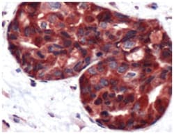 CAST, Rabbit, Polyclonal Antibody, Abnova 100 &mu;L | Buy Online | Abnova Corporation | Fisher Scientific