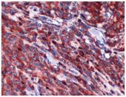 PIM2 Rabbit anti-Human, Polyclonal Antibody, Abnova 100 &mu;L | Buy Online | Abnova Corporation | Fisher Scientific