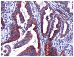LCN2 Rabbit anti-Human, Polyclonal Antibody, Abnova 100 &mu;L | Buy Online | Abnova Corporation | Fisher Scientific