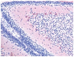 PTN Rabbit anti-Human, Polyclonal Antibody, Abnova 100 &mu;L | Buy Online | Abnova Corporation | Fisher Scientific