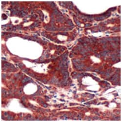 FABP3 Rabbit anti-Human, Polyclonal Antibody, Abnova 100 &mu;L | Buy Online | Abnova Corporation | Fisher Scientific
