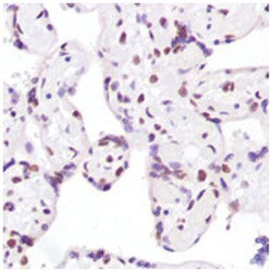 XRCC5 Rabbit anti-Human, Polyclonal Antibody, Abnova 100 &mu;L | Buy Online | Abnova Corporation | Fisher Scientific