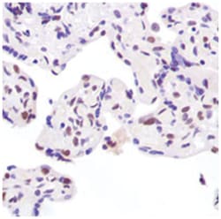 XRCC5 Rabbit anti-Human, Polyclonal Antibody, Abnova 100 &mu;L | Buy Online | Abnova Corporation | Fisher Scientific