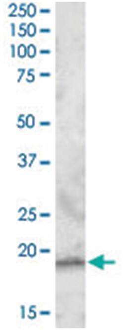 RGS13, Goat, Polyclonal Antibody, Abnova 100&mu;g; Unlabeled:Antibodies,