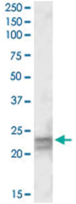 ARL4D, Goat, Polyclonal Antibody, Abnova 100&mu;g; Unlabeled:Antibodies,