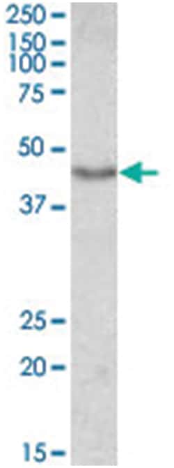 DCX, Goat, Polyclonal Antibody, Abnova 100&mu;g; Unlabeled:Antibodies,
