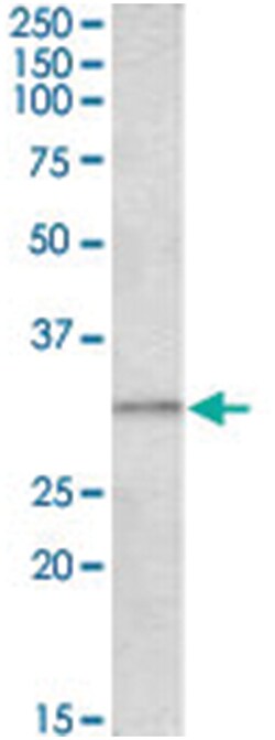 AES, Goat, Polyclonal Antibody, Abnova 100 &mu;g | Buy Online | Abnova | Fisher Scientific