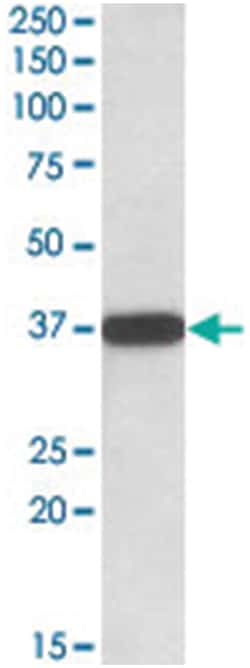 CYB5R3, Goat, Polyclonal Antibody, Abnova 100 &mu;g | Buy Online | Abnova Corporation | Fisher Scientific