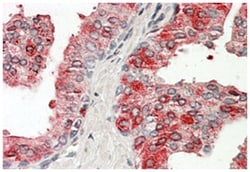 ACPP Goat anti-Human, Polyclonal Antibody, Abnova 100&mu;g; Unlabeled:Antibodies,