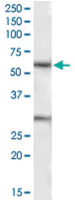 KCNQ1, Goat, Polyclonal Antibody, Abnova 100 &mu;g | Buy Online | Abnova Corporation | Fisher Scientific