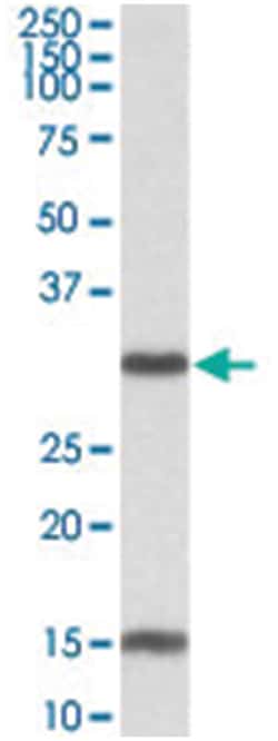 SIRT3 Goat anti-Mouse, Polyclonal Antibody, Abnova 100 &mu;g | Buy Online | Abnova Corporation | Fisher Scientific