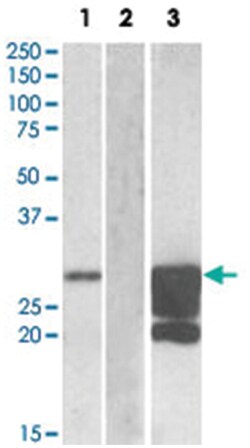 GM2A Goat anti-Human, Polyclonal Antibody, Abnova 100&mu;g; Unlabeled:Antibodies,