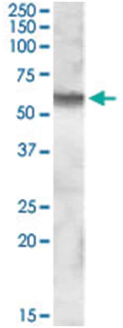 IDS, Goat, Polyclonal Antibody, Abnova 100&mu;g; Unlabeled:Antibodies,