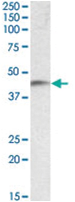 NDRG2, Goat, Polyclonal Antibody, Abnova 100 &mu;g | Buy Online | Abnova Corporation | Fisher Scientific