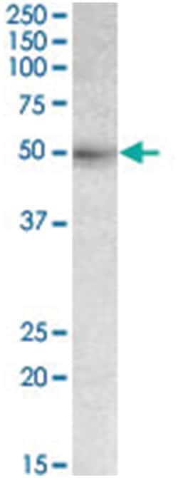 SLC46A1, Goat, Polyclonal Antibody, Abnova 100&mu;g; Unlabeled:Antibodies,