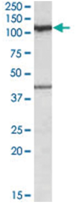 COG1, Goat, Polyclonal Antibody, Abnova 100 &mu;g | Buy Online | Abnova Corporation | Fisher Scientific