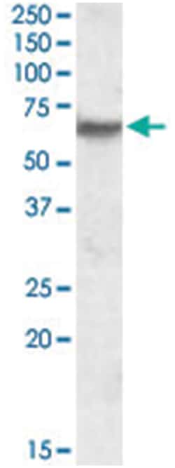 IMPDH2, Goat, Polyclonal Antibody, Abnova 100 &mu;g | Buy Online | Abnova Corporation | Fisher Scientific