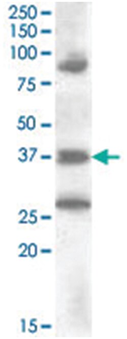 HOXD10, Goat, Polyclonal Antibody, Abnova 100 &mu;g | Buy Online | Abnova Corporation | Fisher Scientific