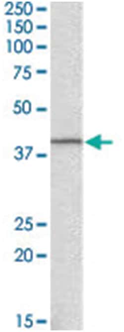 GNAQ, Goat, Polyclonal Antibody, Abnova 100 &mu;g | Buy Online | Abnova Corporation | Fisher Scientific