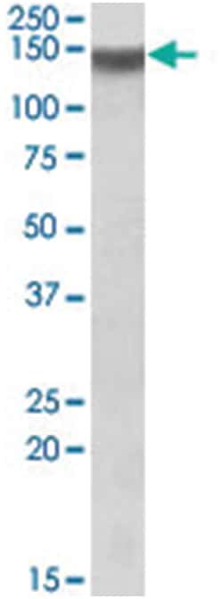 Itga11, Goat, Polyclonal Antibody, Abnova 100 &mu;g | Buy Online | Abnova Corporation | Fisher Scientific