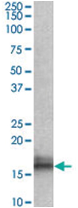 NPC2 Goat anti-Mouse, Polyclonal Antibody, Abnova 100 &mu;g | Buy Online | Abnova Corporation | Fisher Scientific
