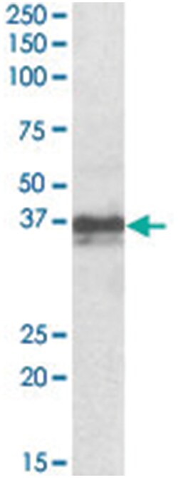 Foxi3, Goat, Polyclonal Antibody, Abnova 100&mu;g; Unlabeled:Antibodies,