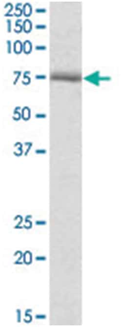 Crot, Goat, Polyclonal Antibody, Abnova 100 &mu;g | Buy Online | Abnova Corporation | Fisher Scientific