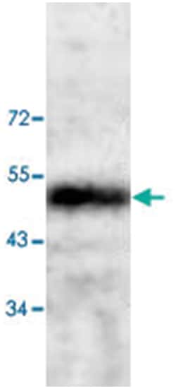 CNN3, Rabbit, Polyclonal Antibody, Abnova 100 &mu;g | Buy Online | Abnova Corporation | Fisher Scientific