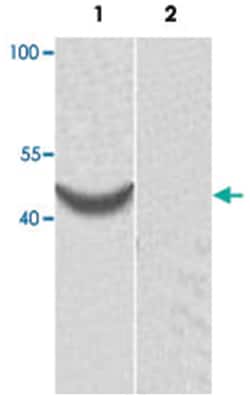 ACTR1B, Rabbit, Polyclonal Antibody, Abnova 100&mu;g; Unlabeled:Antibodies,