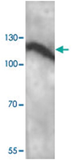 ADCY6, Rabbit, Polyclonal Antibody, Abnova 100&mu;g; Unlabeled:Antibodies,