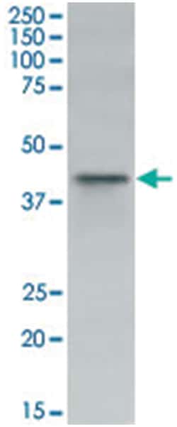 IDH3B Goat anti-Mouse, Polyclonal Antibody, Abnova 100 &mu;g | Buy Online | Abnova Corporation | Fisher Scientific