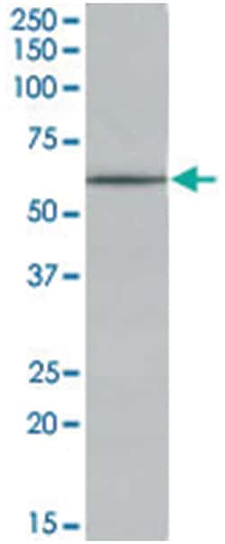 TPH2 Goat anti-Human, Polyclonal Antibody, Abnova 100 &mu;g | Buy Online | Abnova Corporation | Fisher Scientific