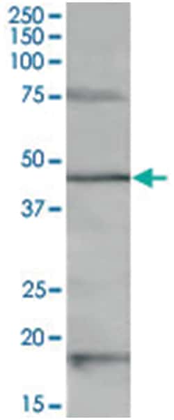 Abnova Corporation HTR1A, Goat, Polyclonal Antibody, Abnova™