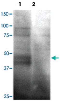 SLC2A1 Rabbit anti-Human, Polyclonal Antibody, Abnova 100&mu;L; Unlabeled:Antibodies,