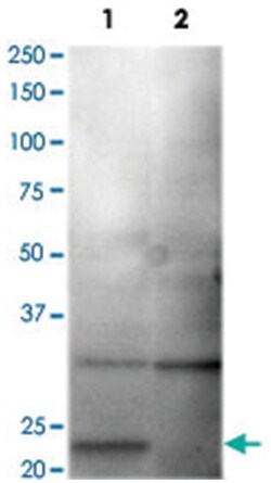 CLDN1 Rabbit anti-Human, Polyclonal Antibody, Abnova 100&mu;L; Unlabeled:Antibodies,