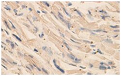 TRAK2 Rabbit anti-Human, Polyclonal Antibody, Abnova 100&mu;g; Unlabeled:Antibodies,