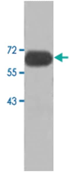 AMH, Rabbit, Polyclonal Antibody, Abnova 100&mu;g; Unlabeled:Antibodies,