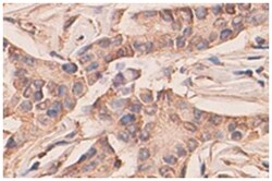 AMIGO2 Rabbit anti-Human, Polyclonal Antibody, Abnova 100 &mu;g | Buy Online | Abnova Corporation | Fisher Scientific