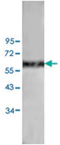 ANGPT1 Rabbit anti-Human, Mouse, Polyclonal Antibody, Abnova 100&mu;g;