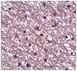 ANGPT1 Rabbit anti-Human, Mouse, Polyclonal Antibody, Abnova 100&mu;g;