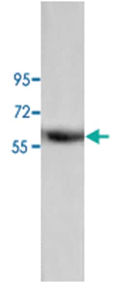 ANXA11, Rabbit, Polyclonal Antibody, Abnova 100 &mu;g | Buy Online | Abnova Corporation | Fisher Scientific