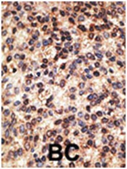 JAG2 Rabbit anti-Human, Polyclonal Antibody, Abnova 400 &mu;L | Buy Online | Abnova Corporation | Fisher Scientific