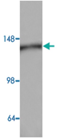 AP3D1 Rabbit anti-Human, Polyclonal Antibody, Abnova 100 &mu;g | Buy Online | Abnova Corporation | Fisher Scientific