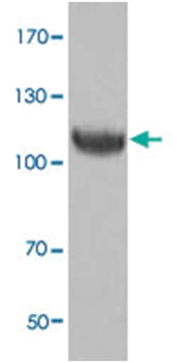 Tnk2, Rabbit, Polyclonal Antibody, Abnova 100&mu;g; Unlabeled:Anticorps,